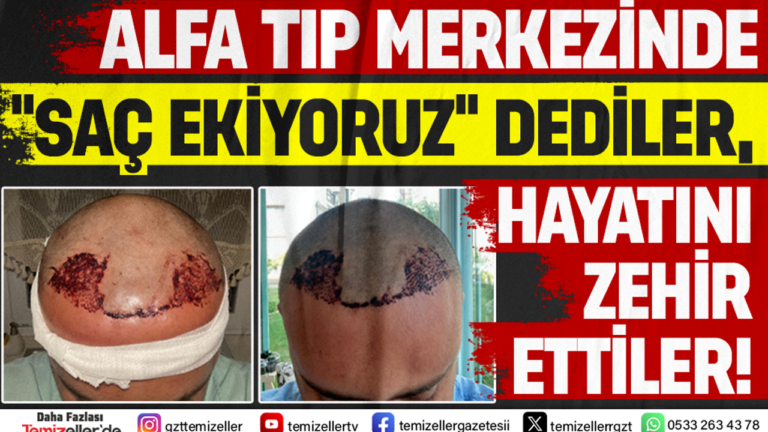 alfa-tip-merkezinde-sac-ekiyoruz-dediler-hayati-zehir-ettiler-jccSYn9x.png