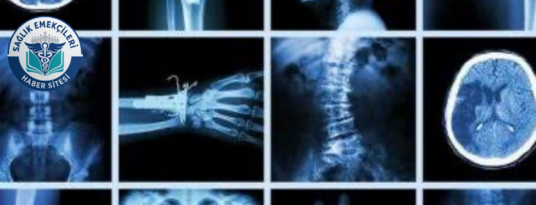 radyoloji-skandali-iddiasi-savcilik-harekete-gecti-yanlis-raporlar-mercek-altinda-saglik-emekcileri-haber-kanali-UkMz3bI1.png