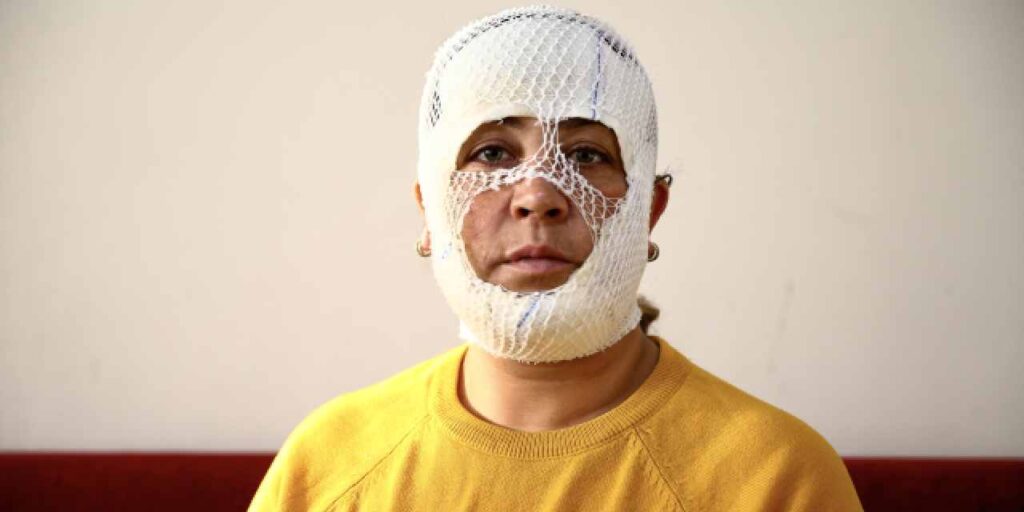 prenses-bakim-kabusu-oldu-solugu-hastanede-aldi-gtVaqIFV